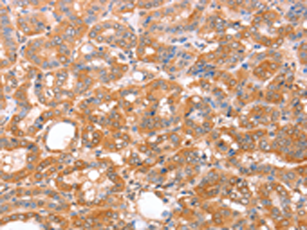 Anti-ACAD9 Rabbit Polyclonal Antibody