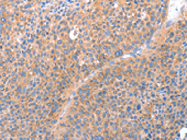 Anti-ACADS Rabbit Polyclonal Antibody