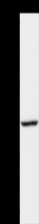 Anti-ACADS Rabbit Polyclonal Antibody