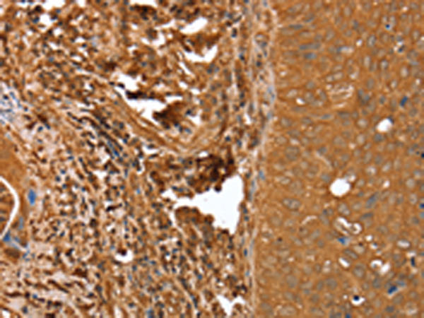 Anti-Calponin 3 Rabbit Polyclonal Antibody