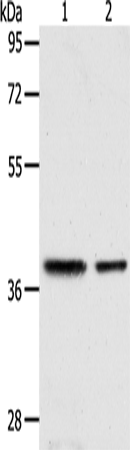 Anti-Calponin 3 Rabbit Polyclonal Antibody