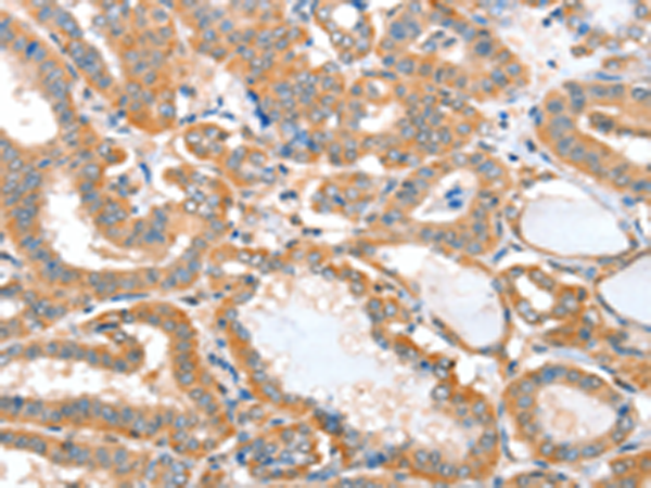 Anti-ACOT11 Rabbit Polyclonal Antibody