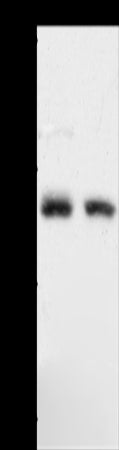 Anti-ACOT11 Rabbit Polyclonal Antibody