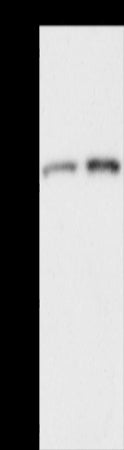 Anti-ACOX2 Rabbit Polyclonal Antibody