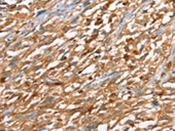 Anti-Actin Regulatory Protein CAPG Rabbit Polyclonal Antibody