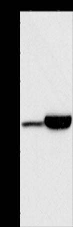 Anti-Actin Regulatory Protein CAPG Rabbit Polyclonal Antibody