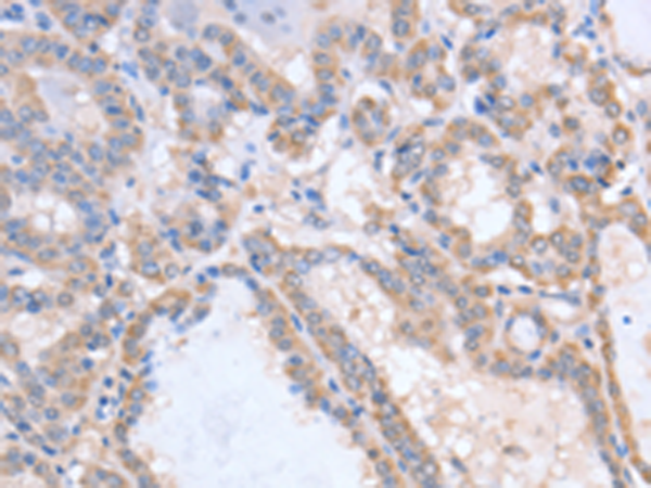 Anti-ALK-7 Rabbit Polyclonal Antibody
