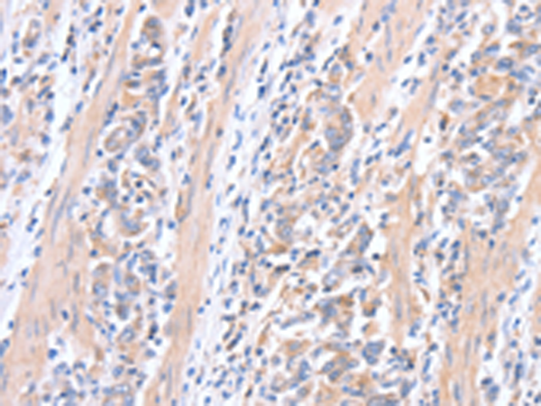 Anti-ACTR3B Rabbit Polyclonal Antibody