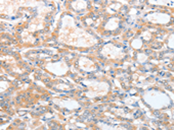 Anti-ACY3 Rabbit Polyclonal Antibody