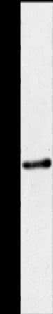 Anti-ACY3 Rabbit Polyclonal Antibody