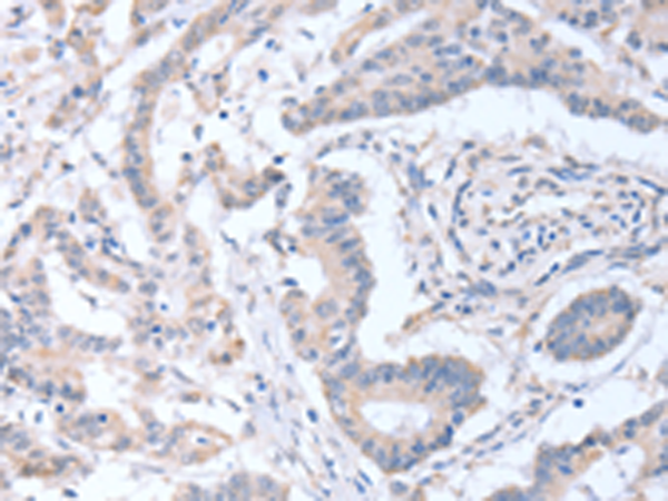 Anti-Acyl-CoA-Thioesterase 9 Rabbit Polyclonal Antibody