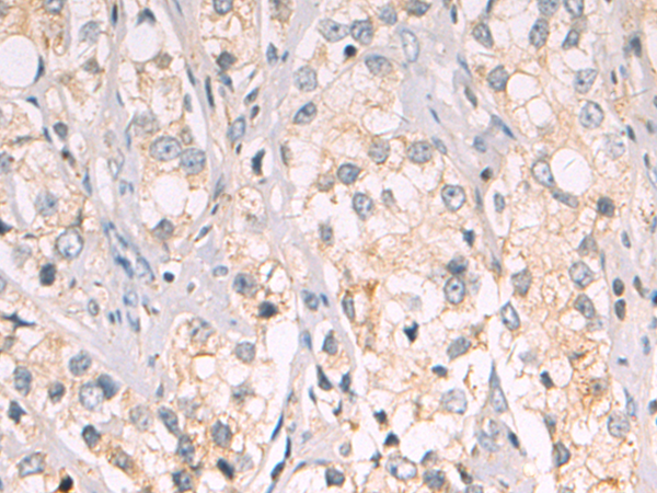 Anti-Adenosine Deaminase Rabbit Polyclonal Antibody