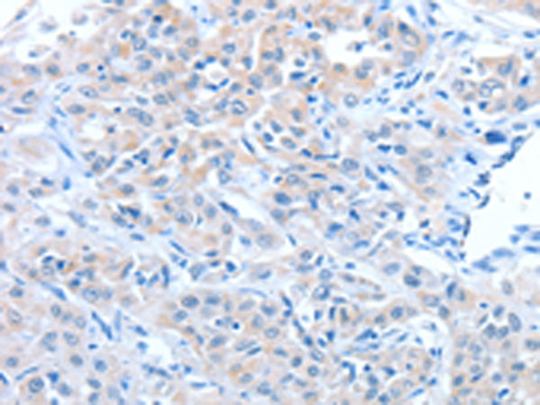 Anti-ADAM7 Rabbit Polyclonal Antibody