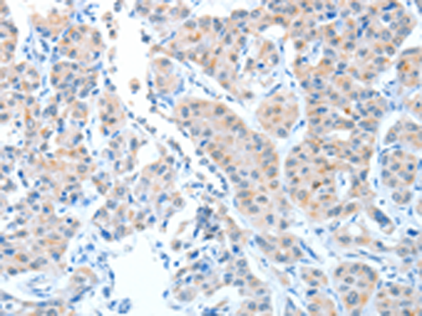 Anti-ADAMTSL1 Rabbit Polyclonal Antibody