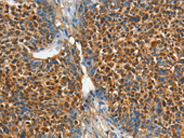 Anti-ADCY4 Rabbit Polyclonal Antibody