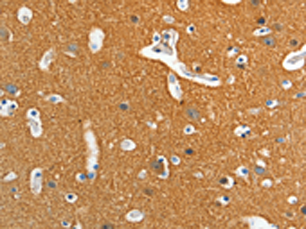 Anti-ADD2 Rabbit Polyclonal Antibody