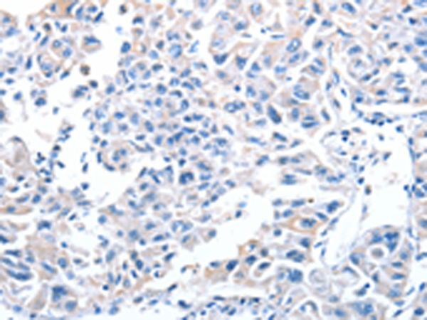 Anti-ADH4 Rabbit Polyclonal Antibody