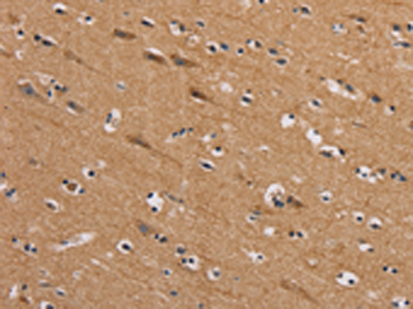 Anti-AAAS Rabbit Polyclonal Antibody