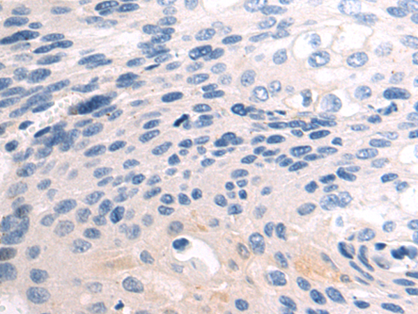 Anti-AFAP1 Rabbit Polyclonal Antibody