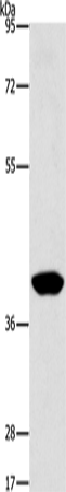 Anti-AGXT2L2 Rabbit Polyclonal Antibody