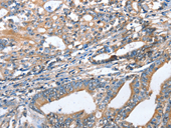 Anti-AKR1D1 Rabbit Polyclonal Antibody