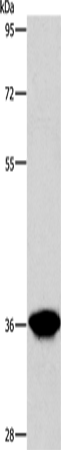 Anti-AKR1D1 Rabbit Polyclonal Antibody