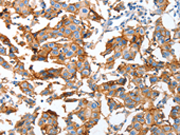 Anti-Aldehyde Oxidase Rabbit Polyclonal Antibody
