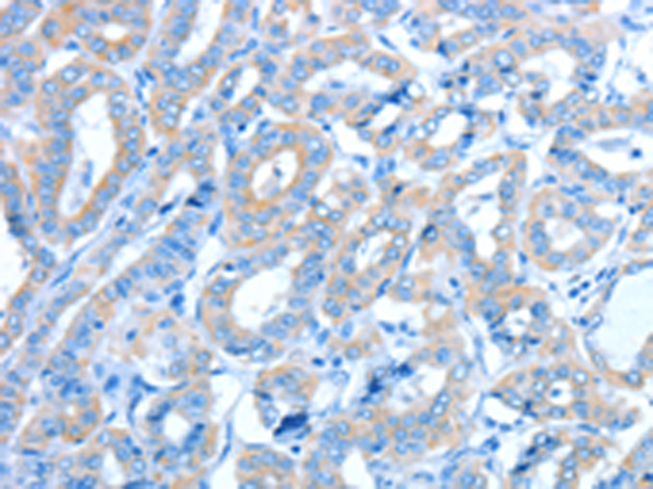 Anti-ALDH3B1 Rabbit Polyclonal Antibody