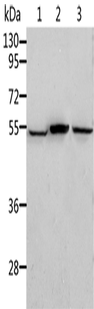 Anti-ALDH3B1 Rabbit Polyclonal Antibody
