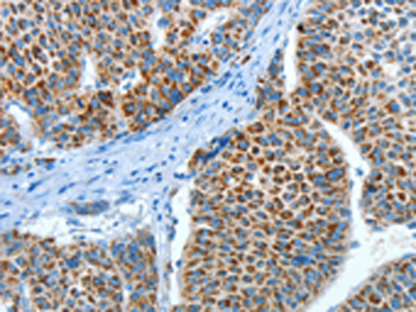Anti-ALDH4A1 Rabbit Polyclonal Antibody