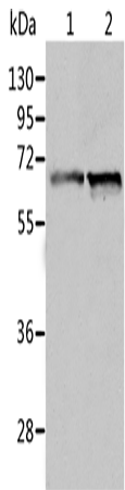 Anti-ALDH4A1 Rabbit Polyclonal Antibody