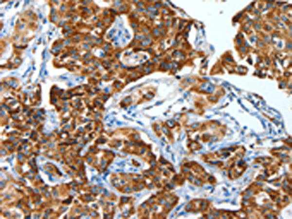 Anti-ALDH6A1 Rabbit Polyclonal Antibody