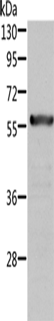 Anti-ALDH6A1 Rabbit Polyclonal Antibody