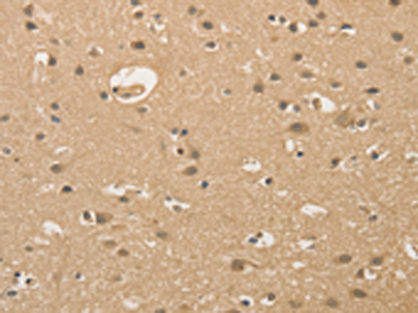 Anti-ALDH8A1 Rabbit Polyclonal Antibody