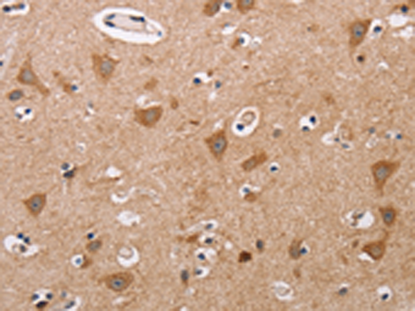 Anti-ALG9 Rabbit Polyclonal Antibody