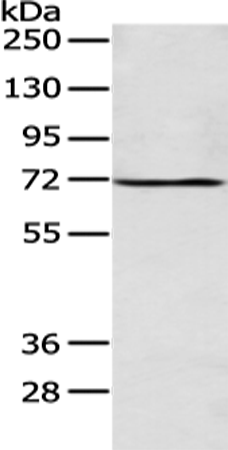 Anti-ALG9 Rabbit Polyclonal Antibody