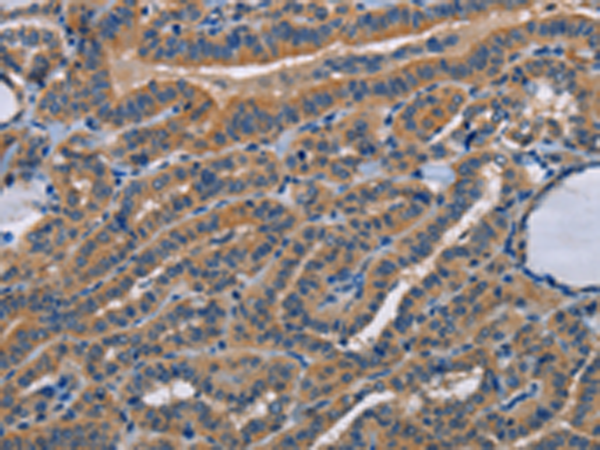 Anti-STRADB Rabbit Polyclonal Antibody