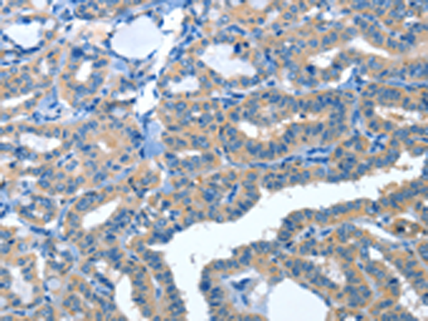 Anti-AMDHD2 Rabbit Polyclonal Antibody