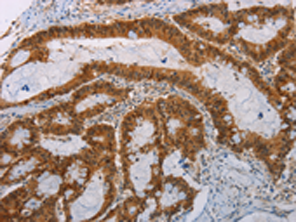 Anti-ACY1 Rabbit Polyclonal Antibody