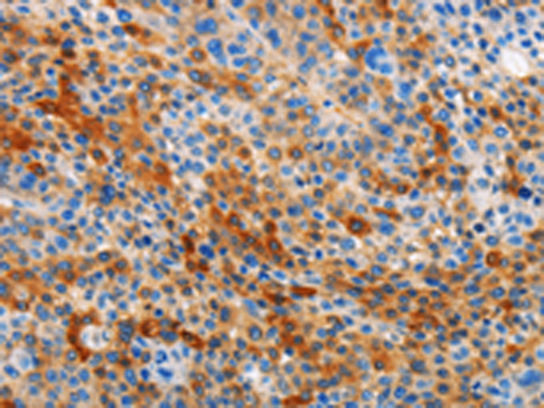 Anti-STAMBP Rabbit Polyclonal Antibody