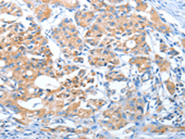 Anti-AUP1 Rabbit Polyclonal Antibody