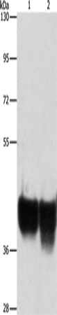 Anti-AUP1 Rabbit Polyclonal Antibody