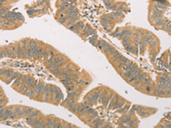 Anti-SNAP91 Rabbit Polyclonal Antibody