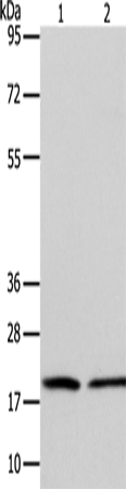 Anti-ANAPC13 Rabbit Polyclonal Antibody