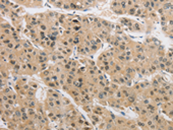 Anti-Archaemetzincin 2 Rabbit Polyclonal Antibody