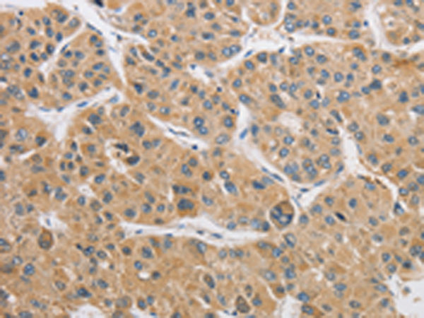 Anti-ARHGAP15 Rabbit Polyclonal Antibody