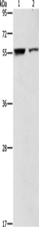 Anti-ARHGAP15 Rabbit Polyclonal Antibody