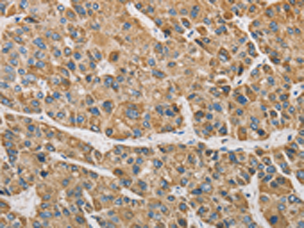 Anti-ARHGAP25 Rabbit Polyclonal Antibody
