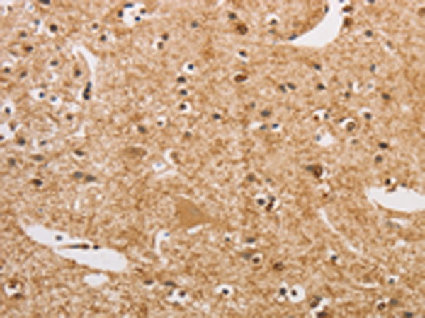Anti-ARHGEF5 Rabbit Polyclonal Antibody