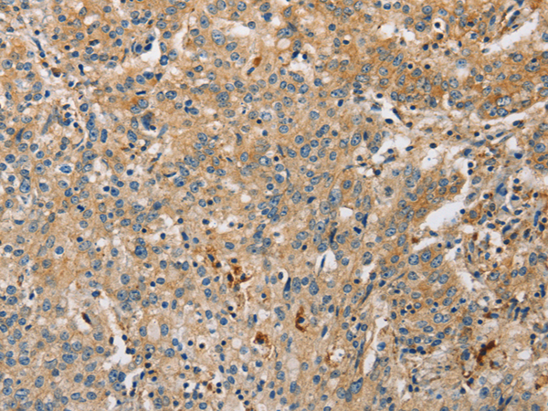 Anti-ARL8A Rabbit Polyclonal Antibody